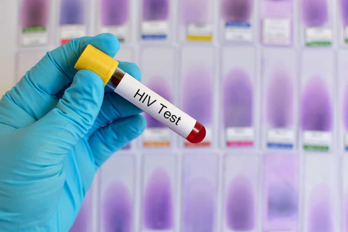 hiv test