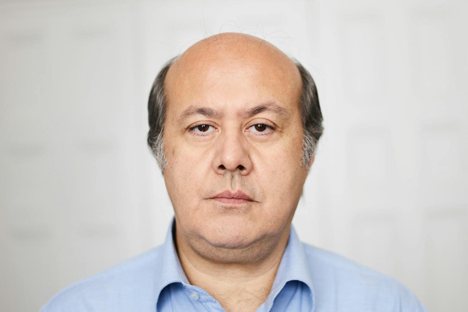 autotrapianto capelli