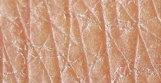 cellule pelle