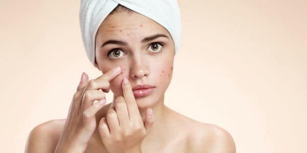 regole sconfiggere acne