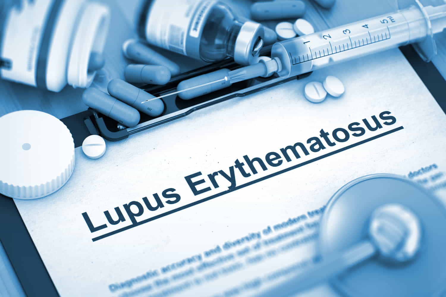 lupus eritematoso