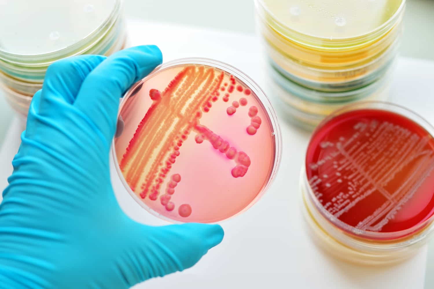 gonorrea resistente