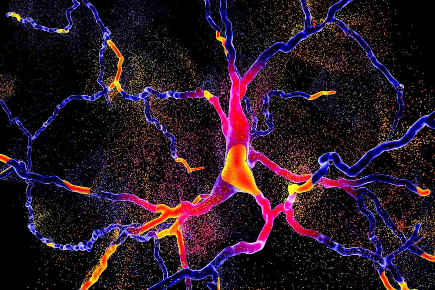 parkinson neuroni