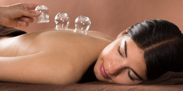 cupping therapy