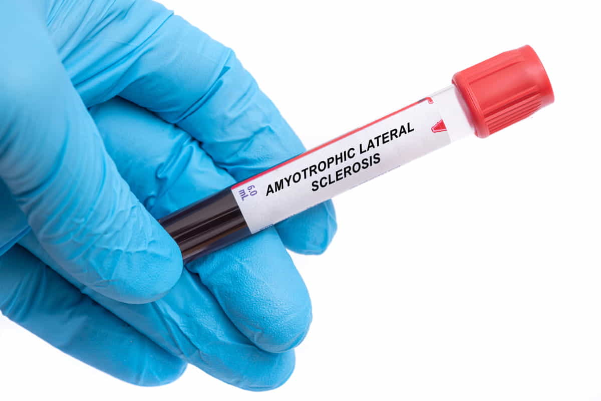 SLA analisi del sangue
