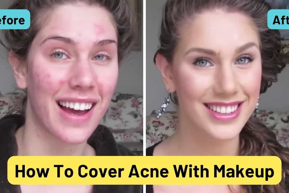 make up acne