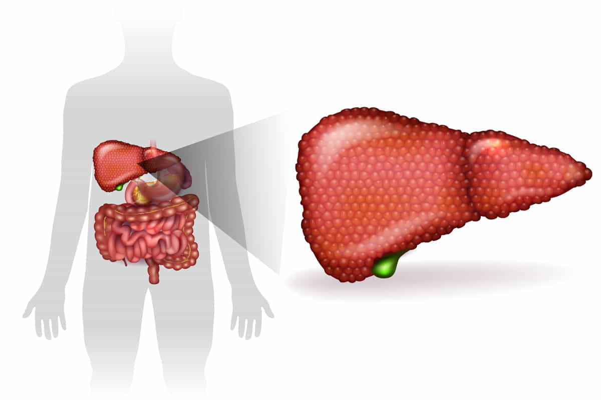 epatite c interferone