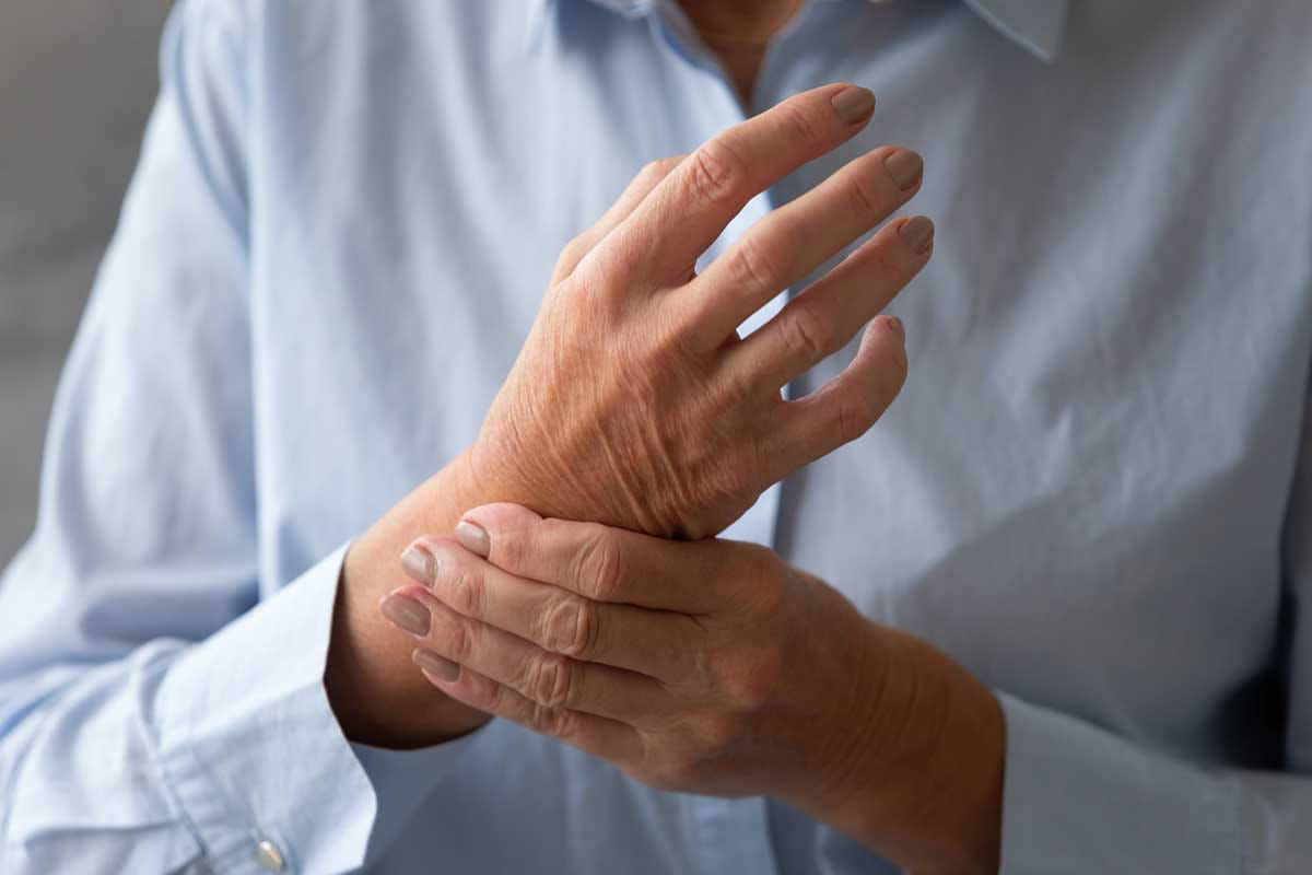 sole artrite reumatoide