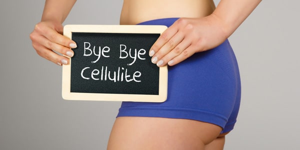 cellulite cause rimedi
