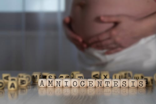 amniocentesi