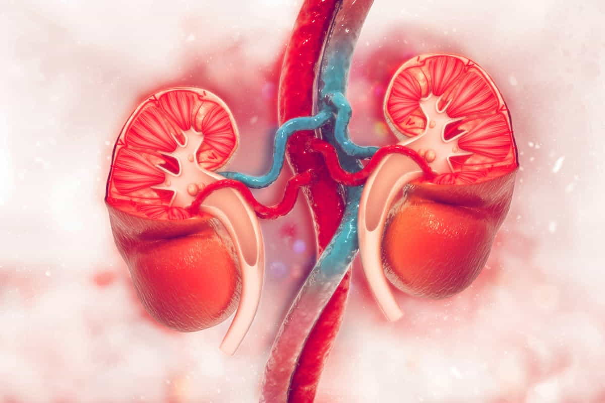 calcoli renali e patologie cardiache