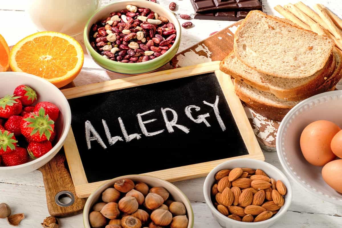 allergie alimentari