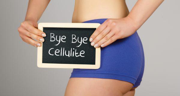 cellulite