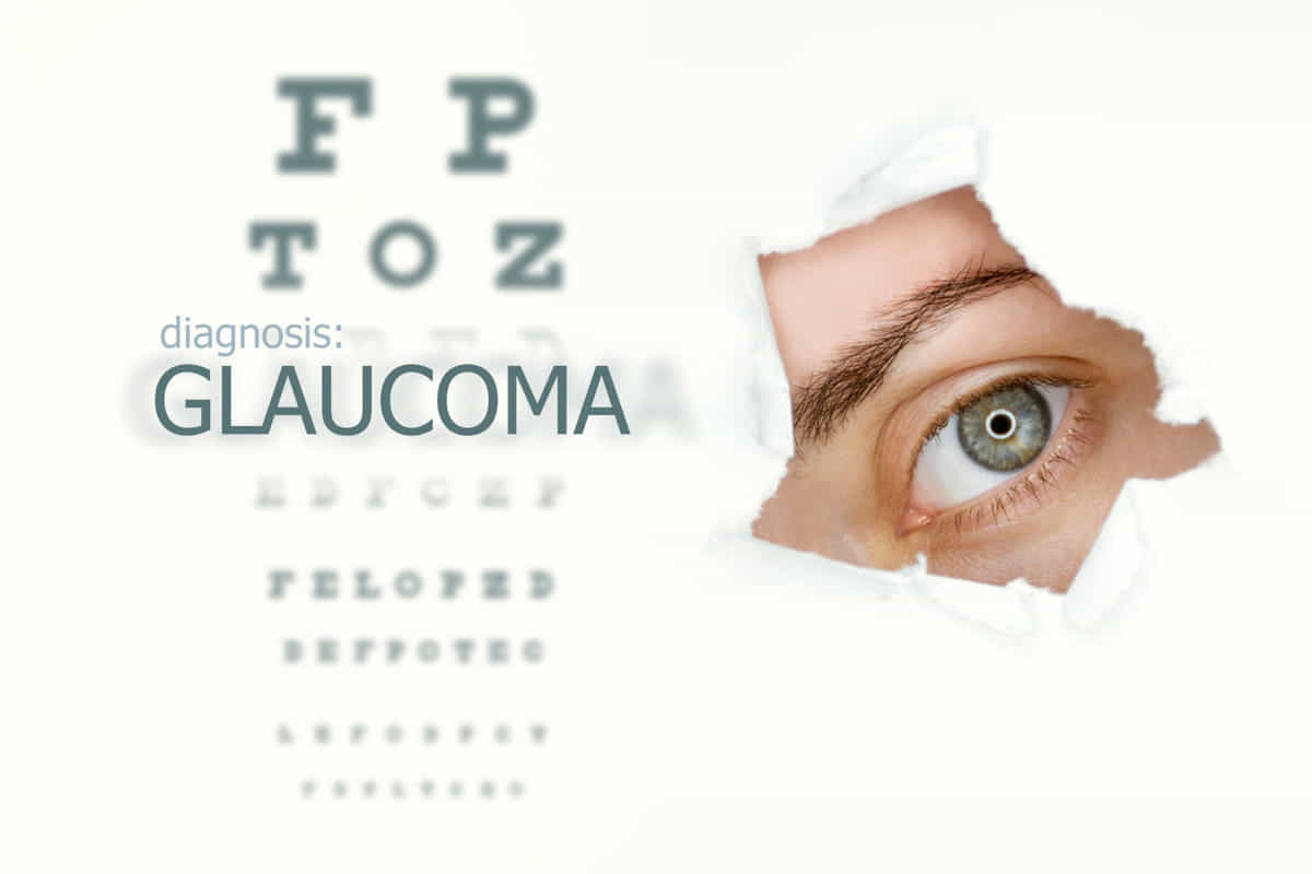 esercizio fisico glaucoma