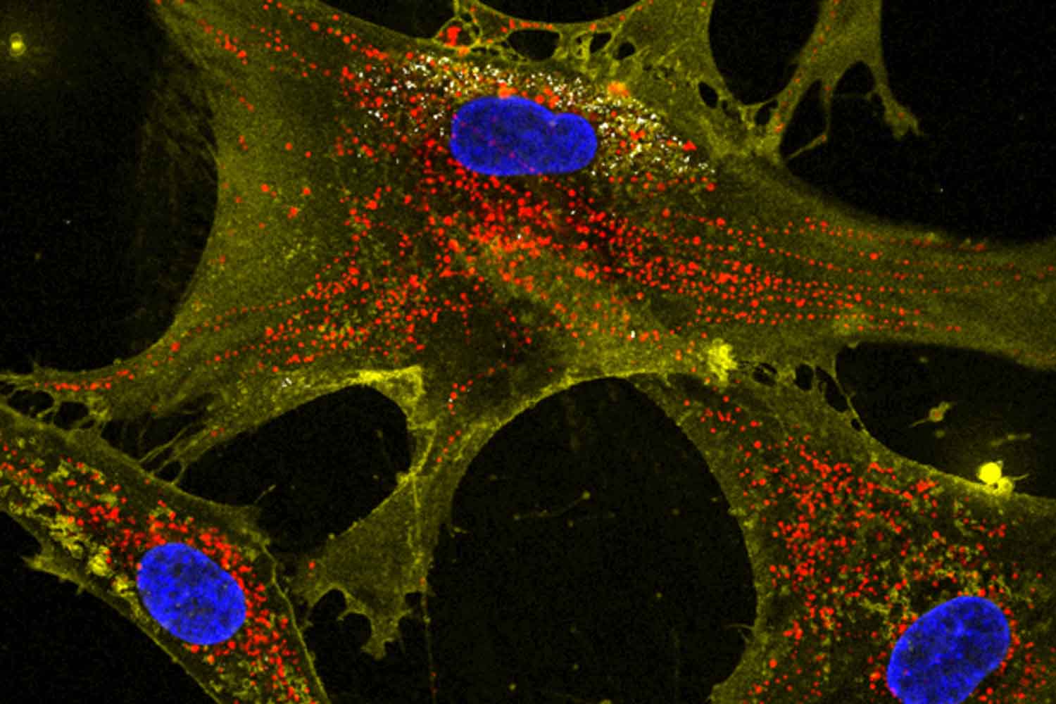 ringiovanire le cellule