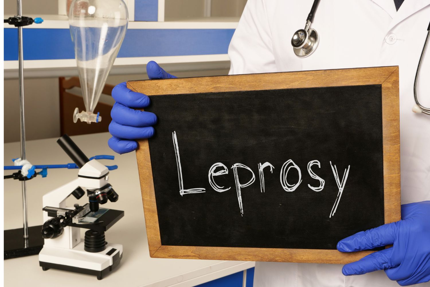 nuovi casi di lebbra