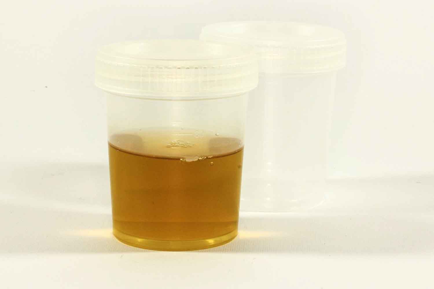 test urine