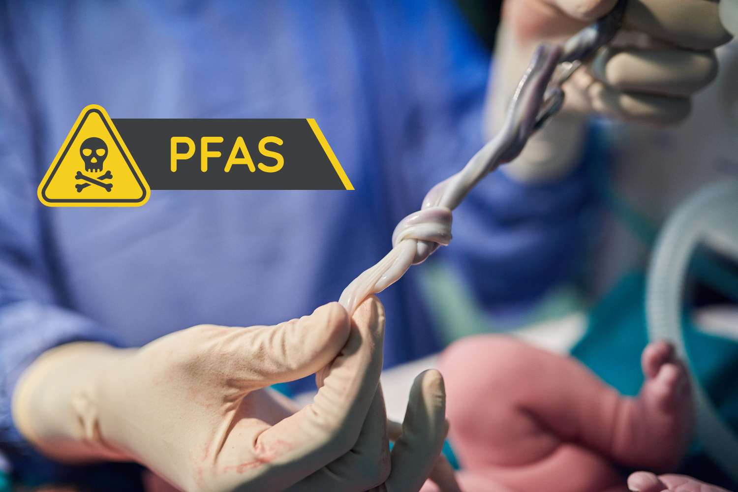 cordone ombelicale pfas