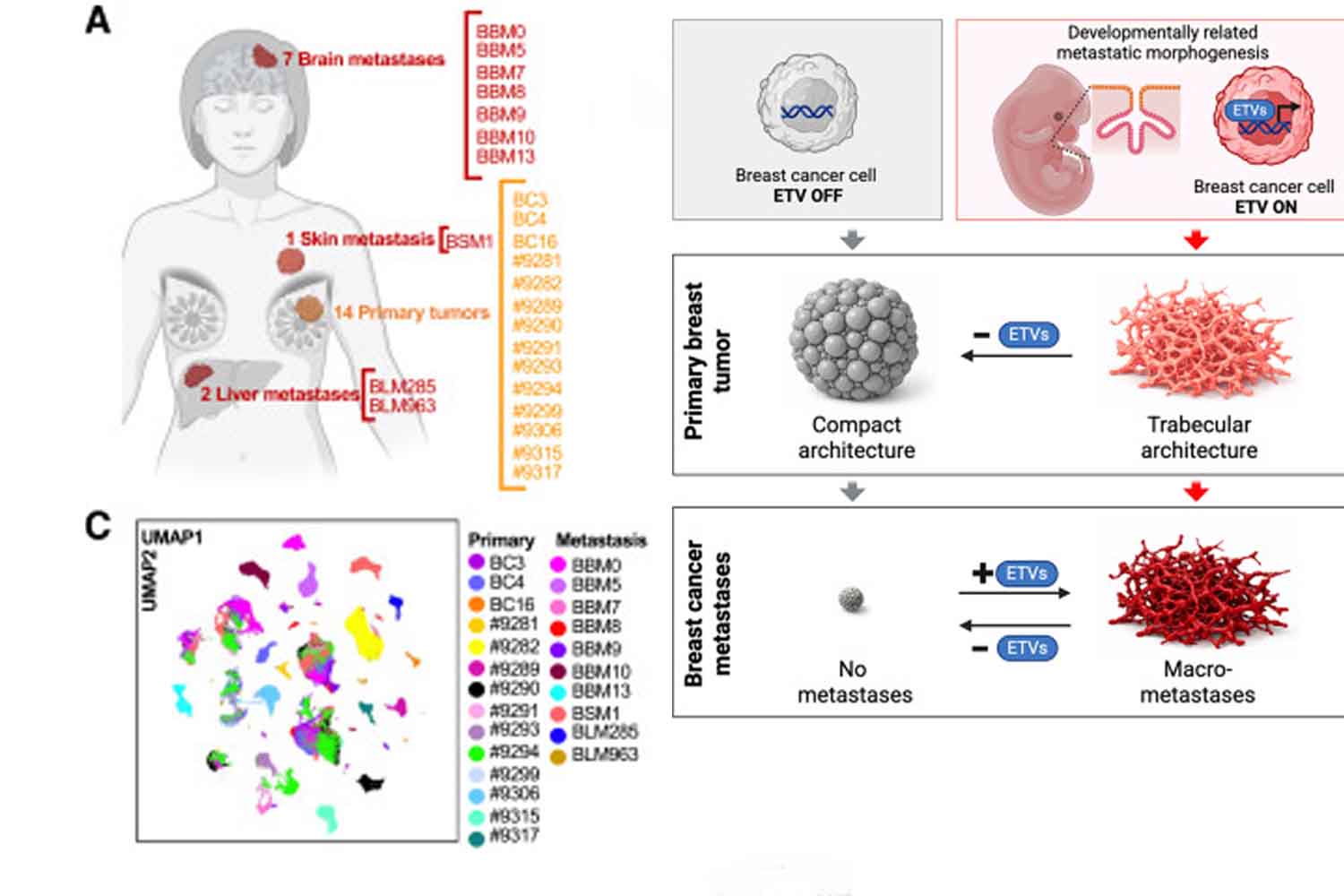 tumore al seno metastasi