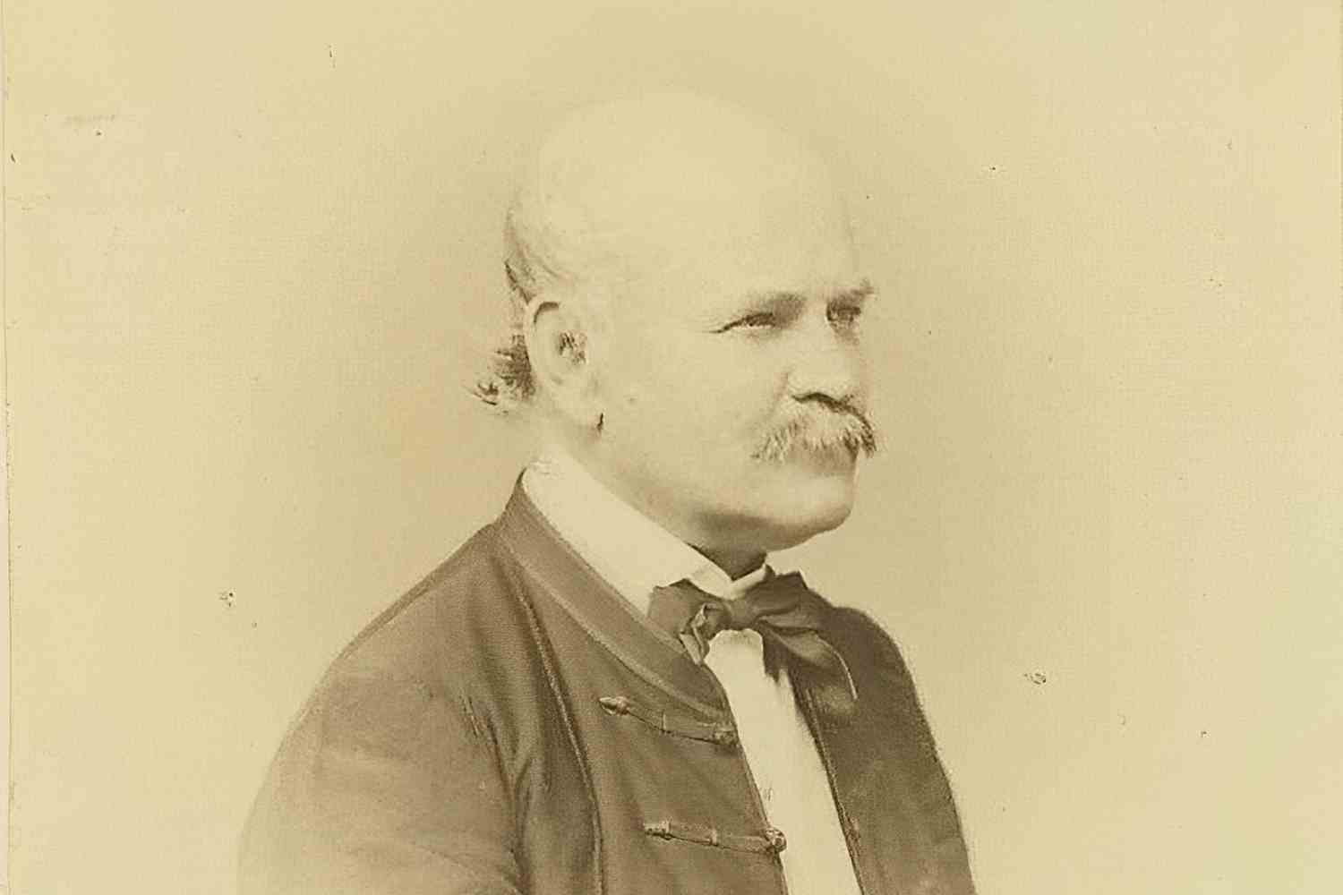 Ignác Semmelweis