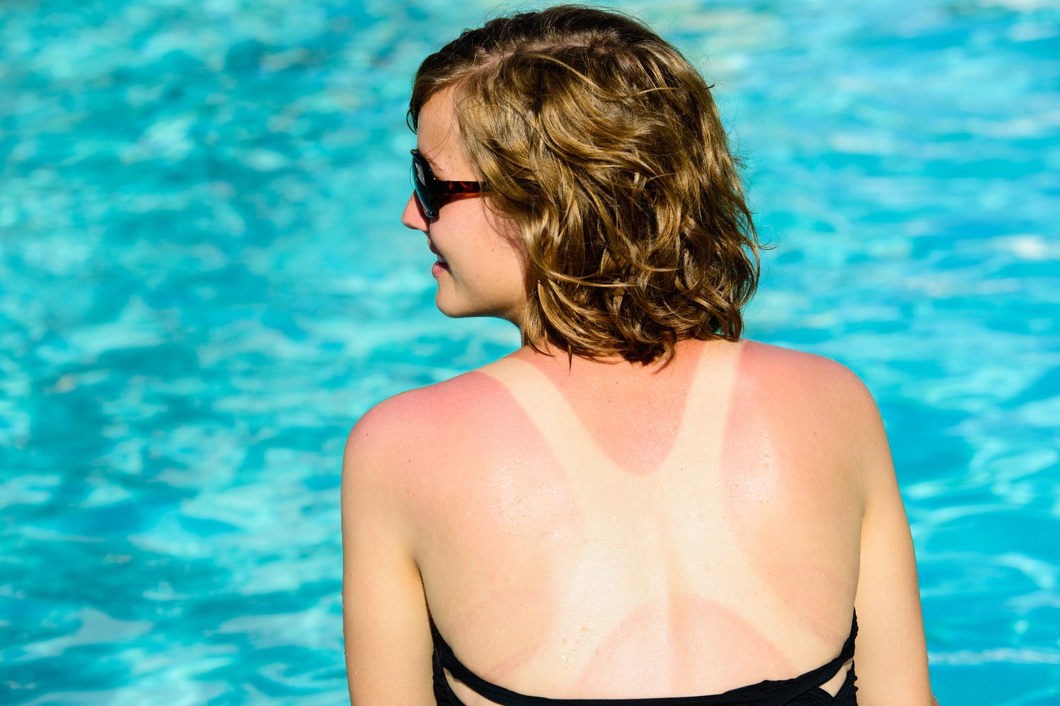 ragazza prende sole