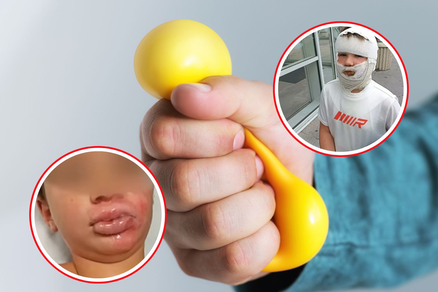 squishy esploso