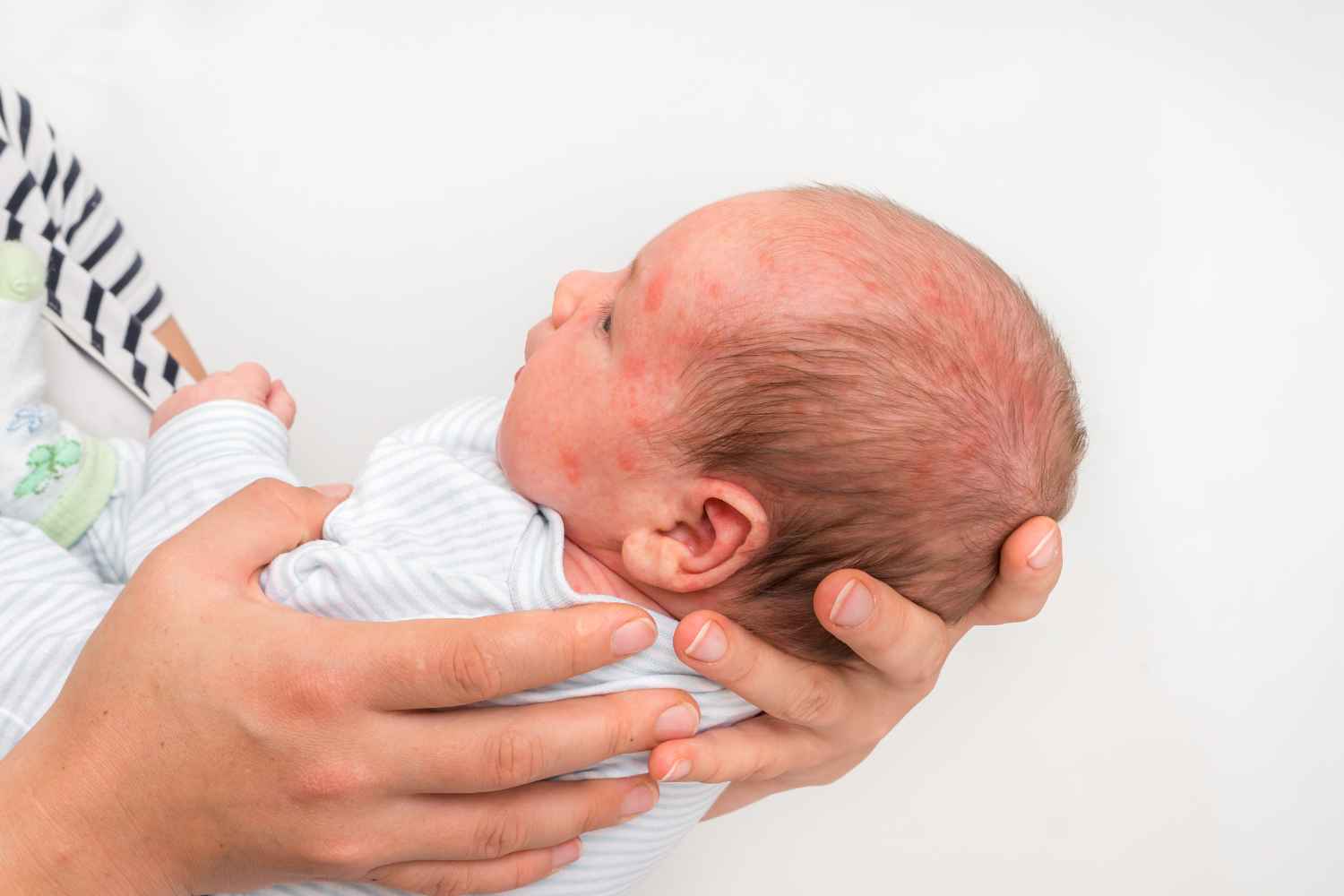 Un gruppo australiano, guidato dall'ex paramedico e mamma Nikki Jurcutz, ha rivelato una semplice regola per capire se uno sfogo cutaneo che compare sulla pelle dei nostri figli può essere sintomo di una malattia pericolosa per la vita